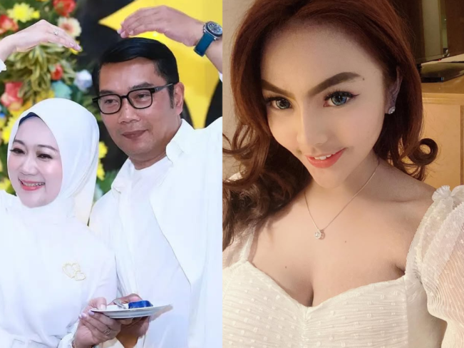 Buntut Bongkar Dugaan Perselingkuhan dengan Ridwan Kamil di Medsos, Kondisi Lisa Mariana Ngedrop